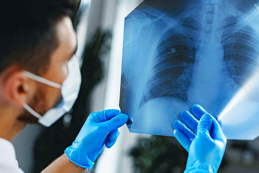 What is Lung Cancer?
