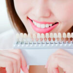 The Benefits Of Cosmetic Dentistry In Adelaide Beyond Aesthetics