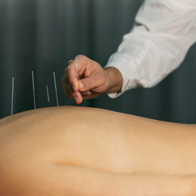 Understanding Eczema Through a TCM Lens Treatments Causes and Recovery