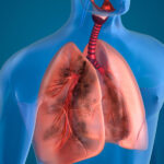 Breathing New Life StemCellCures Stem Cell Therapy for COPD and Lung Disorders
