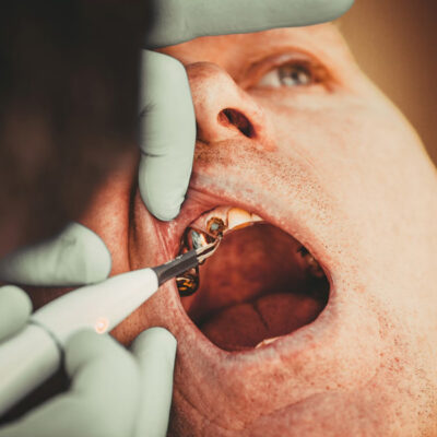 Quality Oral Health Care in Northern Virginia