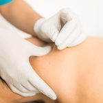 4 Key Differences Between TCM Acupuncture and Western Therapies in Singapore